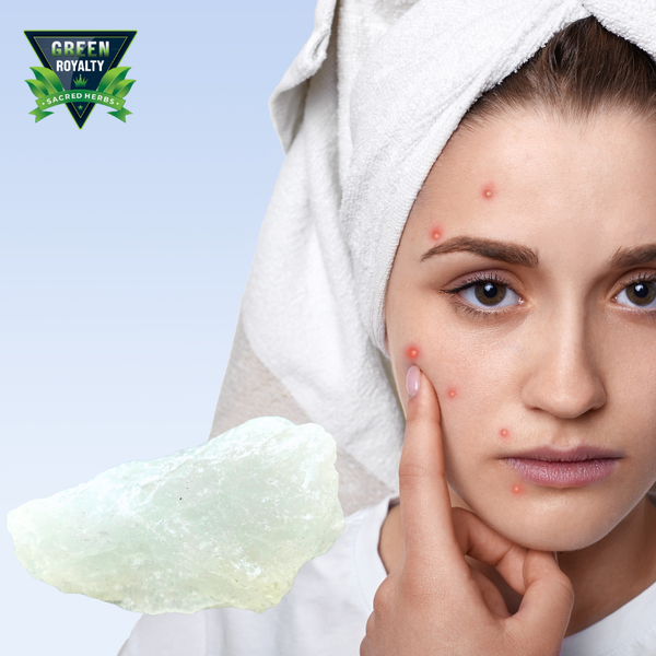 Green Royalty- Piedra de Alumbre(4oz)/ Alum Stone